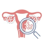 Antral Follicle Count