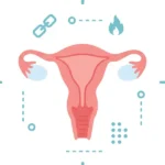 Male Fertility Concerns