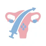 Intrauterine Insemination (IUI)